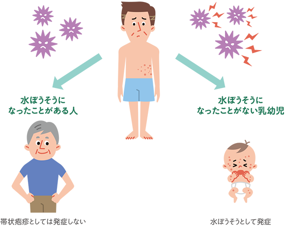 イラスト：帯状疱疹はうつる？うつらない？のイメージ